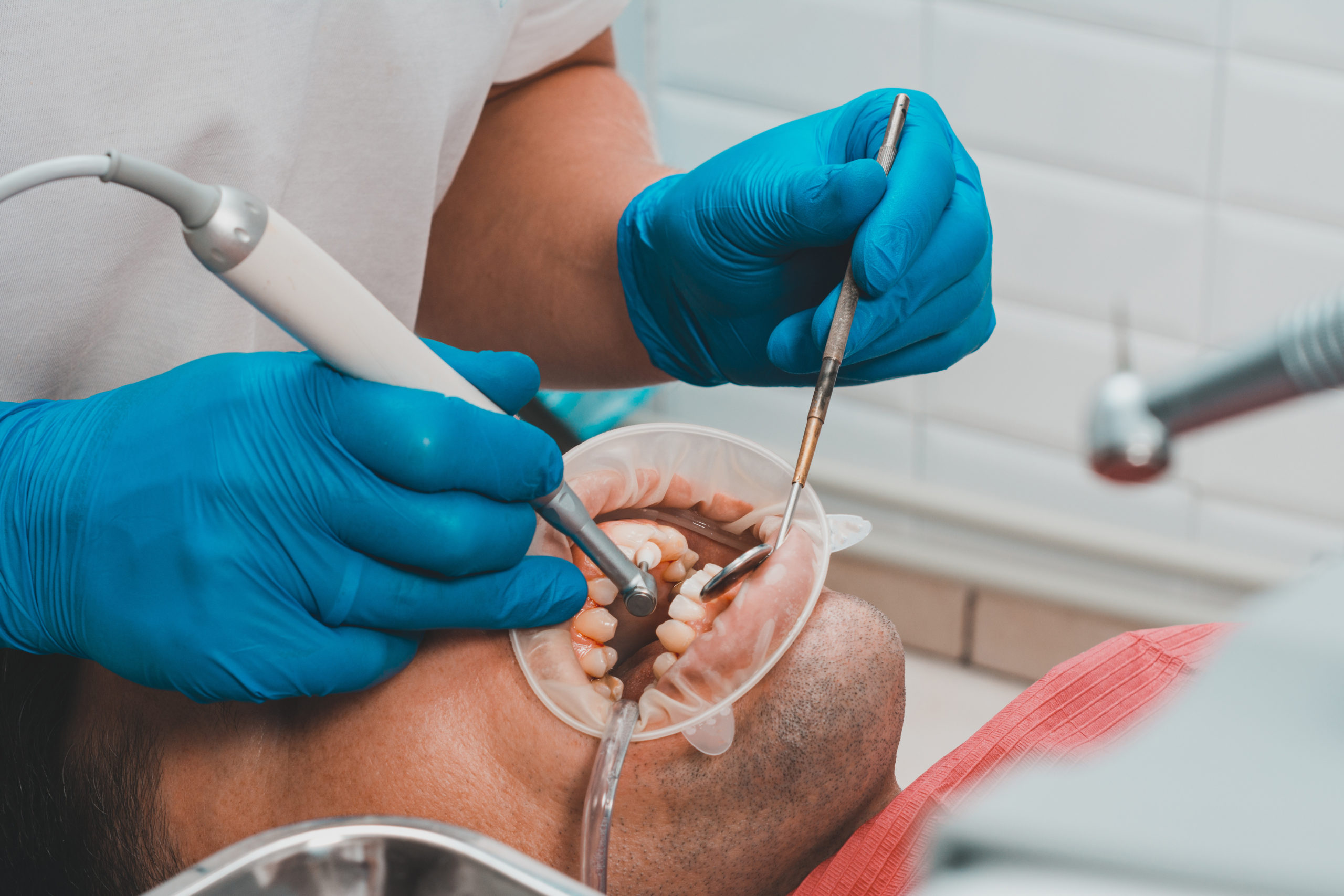 みよし市　歯医者　歯科衛生士の代表的な仕事　後藤歯科