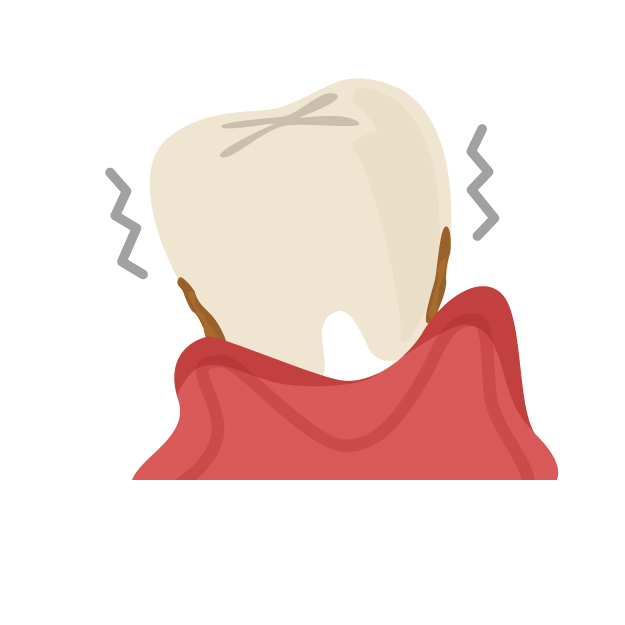 みよし市　歯医者　歯周病　後藤歯科