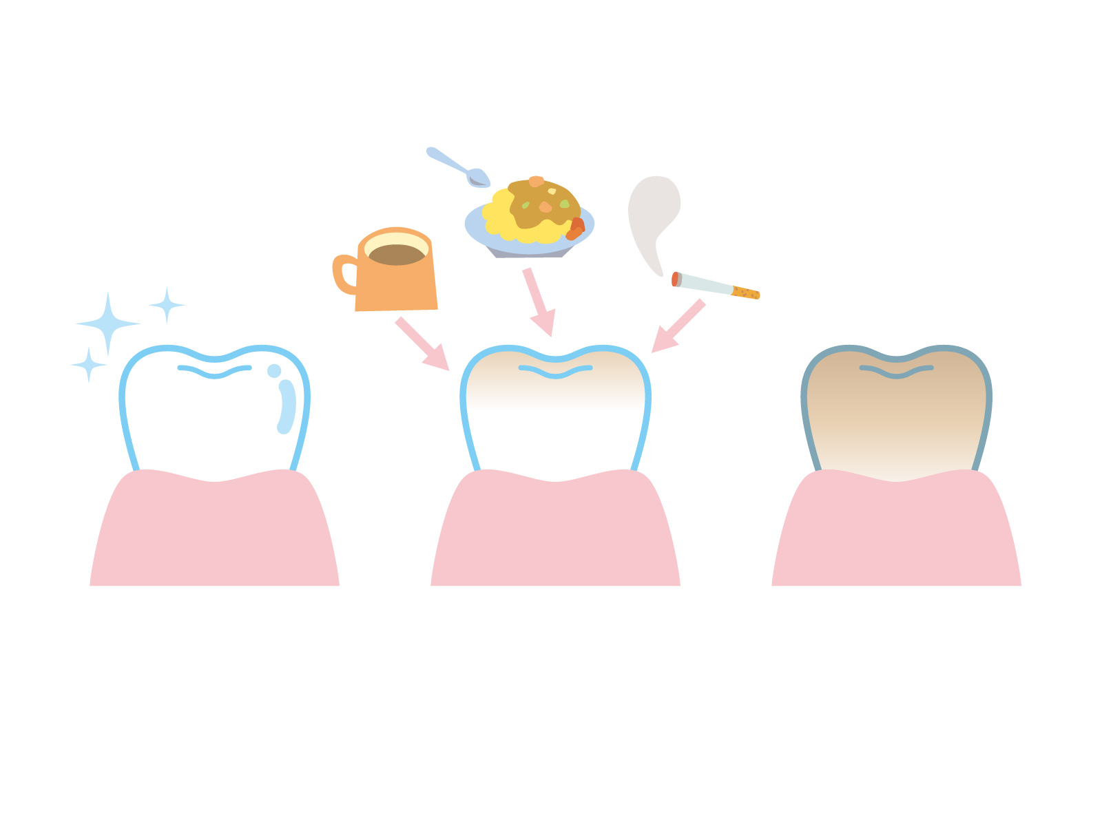 みよし市　歯医者　歯の黄ばみ　後藤歯科