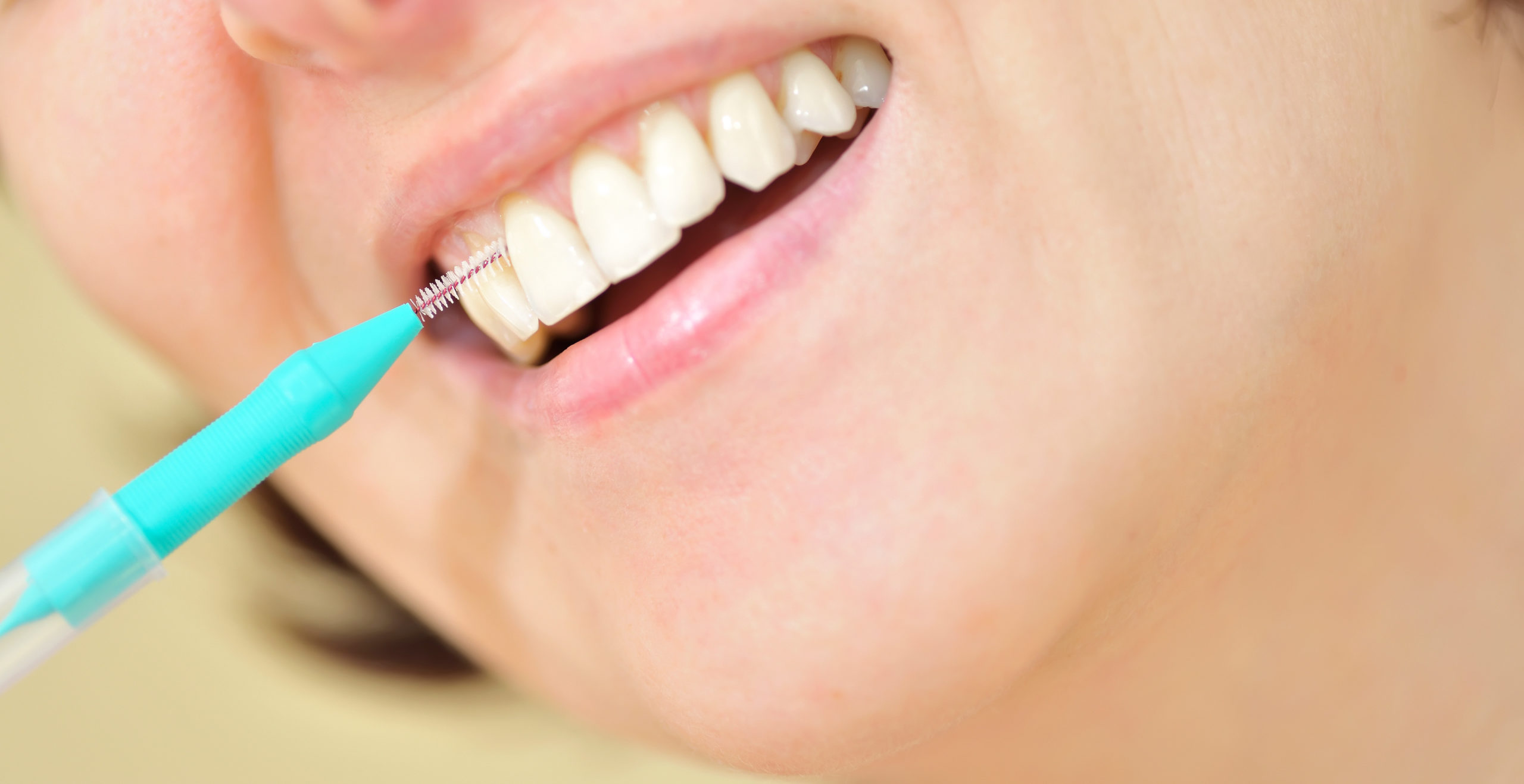 みよし市　歯医者　歯間ブラシやフロスの使い方　後藤歯科