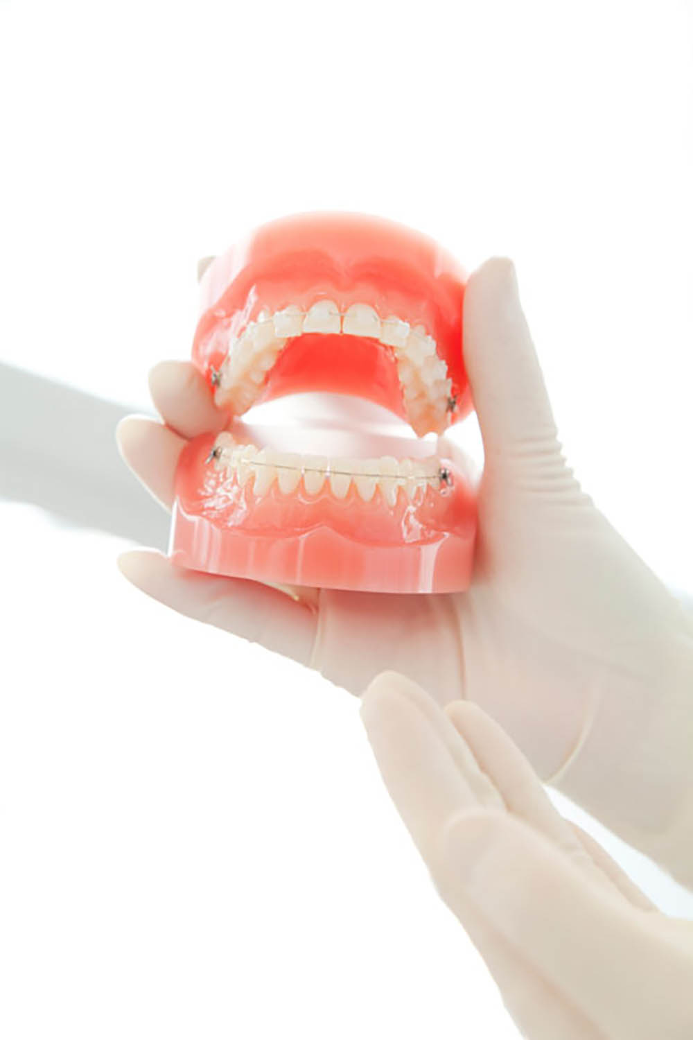 入れ歯のメリットデメリット