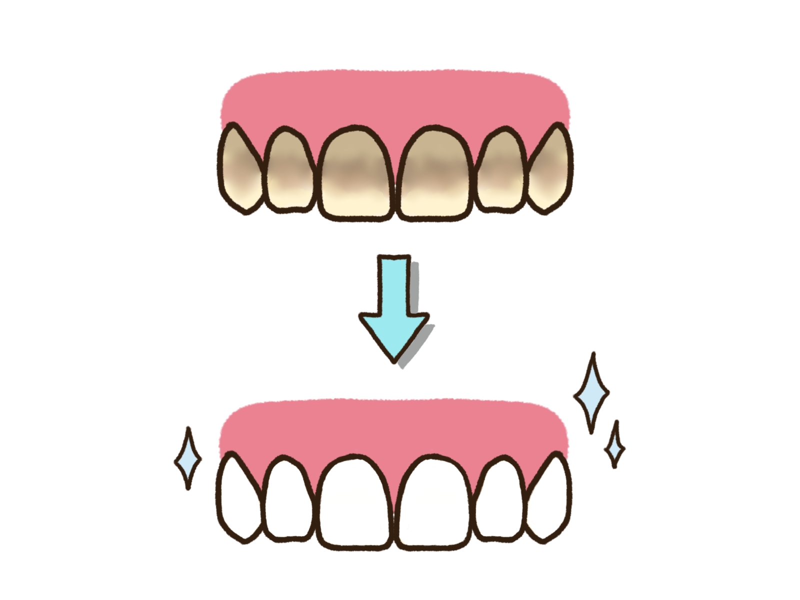 みよし市　歯医者　ホワイトニング　後藤歯科