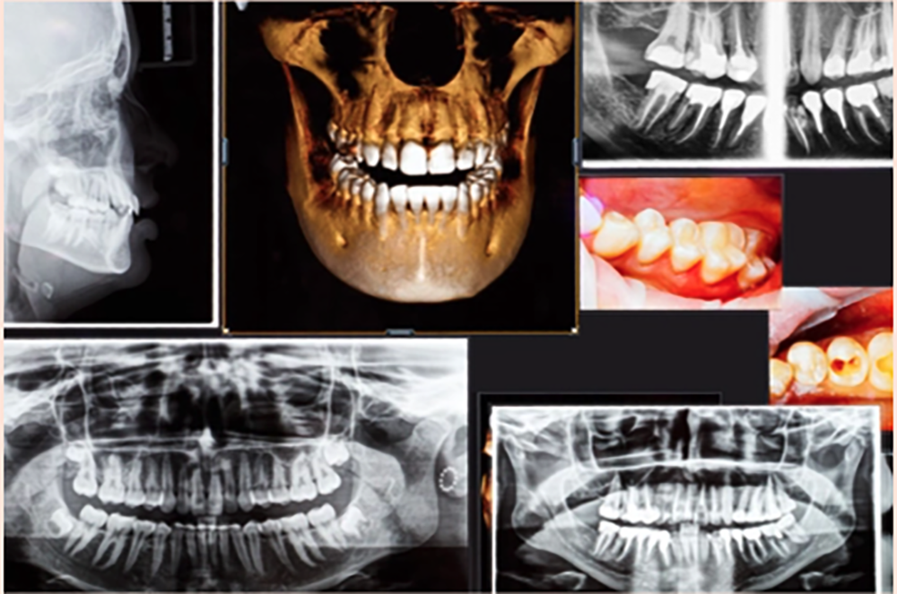 診断と治療計画