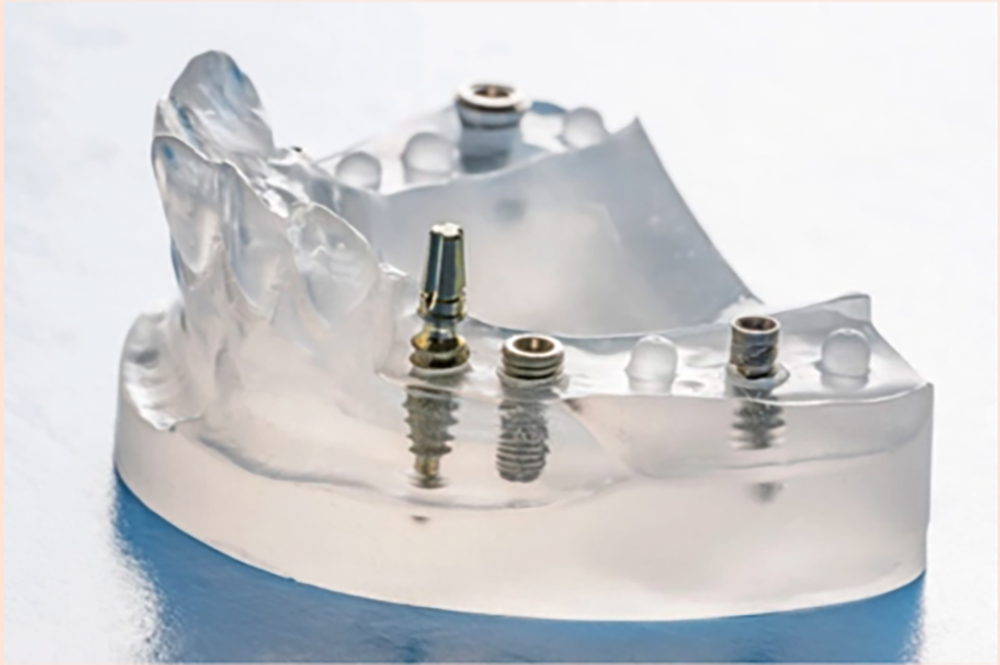 インプラント二次手術