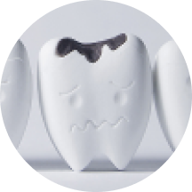 歯が欠けた・被せものが取れた